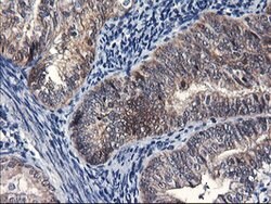 FBXO21 Mouse anti-Human, Clone: OTI1E1, lyophilized, TrueMAB 100 &mu;g;