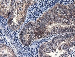 FBXO21 Monoclonal Antibody (OTI1E1), TrueMAB , OriGene 100 &mu;L; Unconjugated:Antibodies,