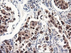 FBXO21 Monoclonal Antibody (OTI3C11), TrueMAB , OriGene 100 &mu;L; Unconjugated:Antibodies,