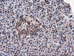 FBXO21 Monoclonal Antibody (OTI3C11), TrueMAB , OriGene 100 &mu;L; Unconjugated:Antibodies,