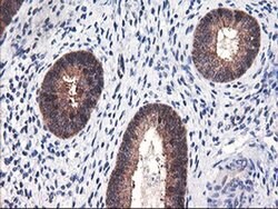 FBXO21 Monoclonal Antibody (OTI3C11), TrueMAB , OriGene 100 &mu;L; Unconjugated:Antibodies,