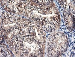 FBXO21 Monoclonal Antibody (OTI3C11), TrueMAB , OriGene 100 &mu;L; Unconjugated:Antibodies,
