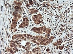 FBXO21 Monoclonal Antibody (OTI2C7), TrueMAB , OriGene 100 &mu;L; Unconjugated:Antibodies,