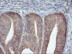 FBXO21 Monoclonal Antibody (OTI2C7), TrueMAB , OriGene 100 &mu;L; Unconjugated:Antibodies,