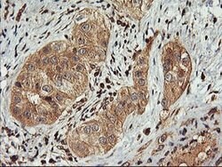 FBXO21 Mouse anti-Canine, Human, Mouse, Rat, Clone: OTI2C7, lyophilized,