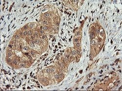 FBXO21 Monoclonal Antibody (OTI2C7), TrueMAB , OriGene 100 &mu;L; Unconjugated:Antibodies,