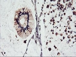 FBXO21 Monoclonal Antibody (OTI2C7), TrueMAB , OriGene 100 &mu;L; Unconjugated:Antibodies,
