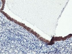 FBXO21 Monoclonal Antibody (OTI2B8), TrueMAB , OriGene 100 &mu;L; Unconjugated:Antibodies,