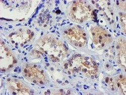 FBXO21 Monoclonal Antibody (OTI2B8), TrueMAB , OriGene 100 &mu;L; Unconjugated:Antibodies,