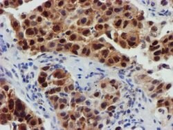 FBXO21 Mouse anti-Human, Mouse, Rat, Clone: OTI5H4, lyophilized, TrueMAB