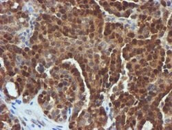 FBXO21 Mouse anti-Human, Mouse, Rat, Clone: OTI5H4, lyophilized, TrueMAB