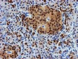 FBXO21 Mouse anti-Human, Mouse, Rat, Clone: OTI5H4, lyophilized, TrueMAB