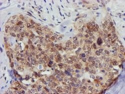 FBXO21 Mouse anti-Human, Mouse, Rat, Clone: OTI5H4, lyophilized, TrueMAB