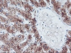 FBXO21 Monoclonal Antibody (OTI5F11), TrueMAB , OriGene 100 &mu;L; Unconjugated:Antibodies,