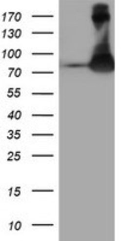 FBXO21 Mouse anti-Human, Clone: OTI1E1, lyophilized, TrueMAB 100 &mu;g;
