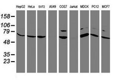 FBXO21 Mouse anti-Canine, Human, Mouse, Rat, Clone: OTI2C7, lyophilized,