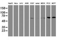 FBXO21 Monoclonal Antibody (OTI2B8), TrueMAB , OriGene 100 &mu;L; Unconjugated:Antibodies,