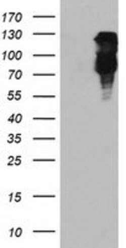FBXO21 Mouse anti-Human, Mouse, Rat, Clone: OTI5H4, lyophilized, TrueMAB