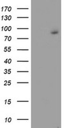 FBXO21 Monoclonal Antibody (OTI5F11), TrueMAB , OriGene 100 &mu;L; Unconjugated:Antibodies,