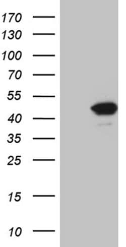 FBXO22 Mouse anti-Human, Mouse, Clone: OTI1H1, liquid, TrueMAB 100 &mu;L;