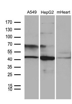 FBXO22 Mouse anti-Human, Mouse, Clone: OTI1H1, liquid, TrueMAB 100 &mu;L;