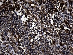FBXO25 Mouse anti-Human, Clone: OTI6F11, lyophilized, TrueMAB 100 &mu;g;