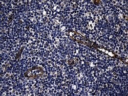 FBXO25 Mouse anti-Human, Clone: OTI6F11, lyophilized, TrueMAB 100 &mu;g;