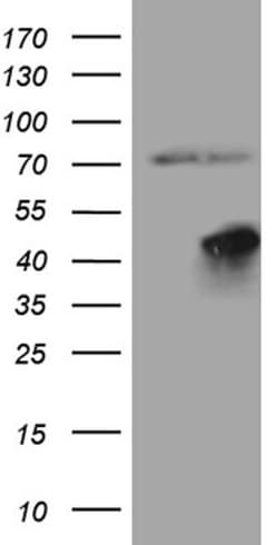 FBXO25 Mouse anti-Human, Clone: OTI1A1, lyophilized, TrueMAB 100 &mu;g;