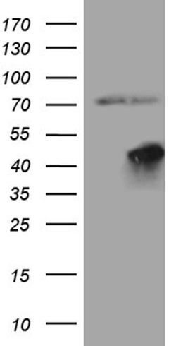FBXO25 Monoclonal Antibody (OTI1A1), TrueMAB , OriGene:Antibodies:Primary