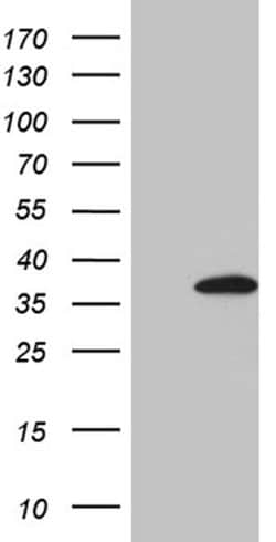 FBXO6 Monoclonal Antibody (OTI7C2), TrueMAB , OriGene 100 &mu;L; Unconjugated:Antibodies,