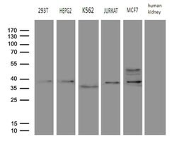FBXO6 Monoclonal Antibody (OTI6A4), TrueMAB , OriGene:Antibodies:Primary