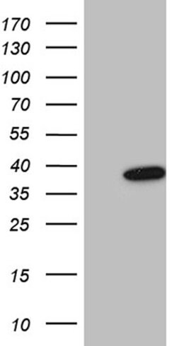 FBXO6 Mouse anti-Human, Clone: OTI1H8, lyophilized, TrueMAB 100 &mu;g;