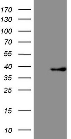 FBXO8 Mouse anti-Human, Clone: OTI9G5, lyophilized, TrueMAB 100 &mu;g;