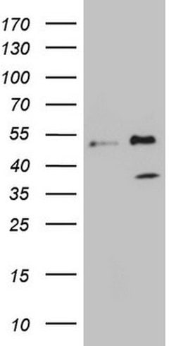 FBXO8 Mouse anti-Human, Clone: OTI1A9, lyophilized, TrueMAB 100 &mu;g;