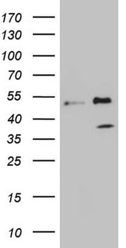 FBXO8 Monoclonal Antibody (OTI1A9), TrueMAB , OriGene 30 &mu;L; Unconjugated:Antibodies,