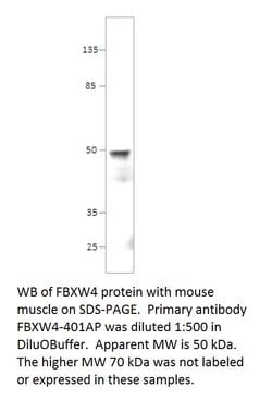 FBXW4/SHFM3 Rabbit anti-Human, Mouse, Non-human Primate, Rat, Polyclonal,