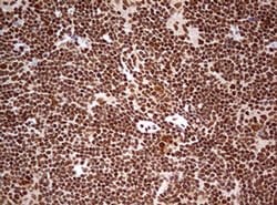 FBXW7 Monoclonal Antibody (OTI13H4), TrueMAB , OriGene 30 &mu;L | Buy Online | Origene Technologies | Fisher Scientific