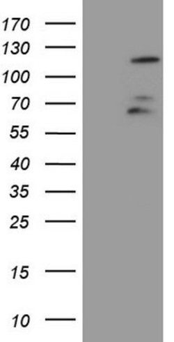 FBXW7 Mouse anti-Human, Clone: OTI6F5, lyophilized, TrueMAB 100 &mu;g;