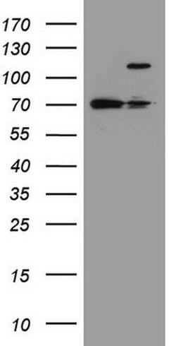 FBXW7 Monoclonal Antibody (OTI13H4), TrueMAB , OriGene 30 &mu;L | Buy Online | Origene Technologies | Fisher Scientific