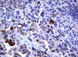 FCER2 Mouse anti-Human, Clone: OTI2B6, lyophilized, TrueMAB 100 &mu;g;