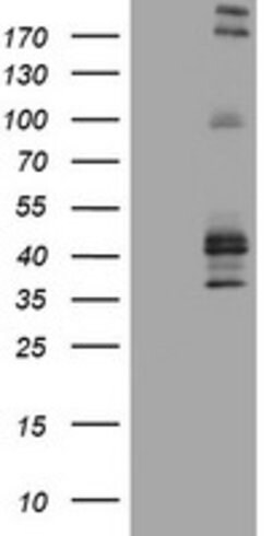 FCER2 Mouse anti-Human, Clone: OTI2B6, lyophilized, TrueMAB 100 &mu;g;