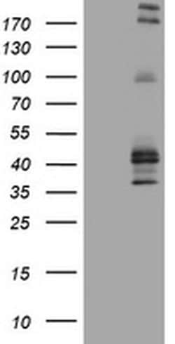 FCER2 Monoclonal Antibody (OTI2B6), TrueMAB , OriGene 100 &mu;L | Buy Online | Origene Technologies | Fisher Scientific