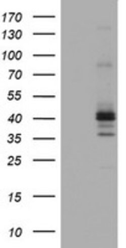FCER2 Mouse anti-Human, Clone: OTI6C2, lyophilized, TrueMAB 100 &mu;g;
