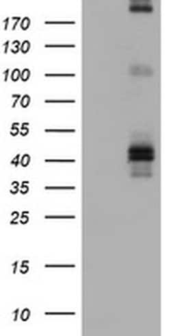 FCER2 Monoclonal Antibody (OTI1E5), TrueMAB , OriGene 100 &mu;L | Buy Online | Origene Technologies | Fisher Scientific