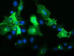 FCGR1A Monoclonal Antibody (OTI1A9), TrueMAB , OriGene:Antibodies:Primary