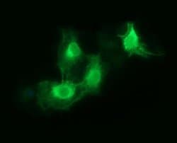 FCGR1A Monoclonal Antibody (OTI3H9), TrueMAB , OriGene 100 &mu;L; Unconjugated:Antibodies,