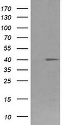 FCGR1A Mouse anti-Human, Clone: OTI3D3, liquid, TrueMAB 100 &mu;L; Unconjugated:Antibodies,
