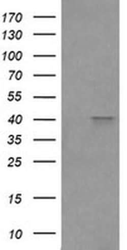 FCGR1A Monoclonal Antibody (OTI1A9), TrueMAB , OriGene 100 &mu;L; Unconjugated:Antibodies,