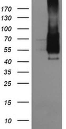 FCGR1A Monoclonal Antibody (OTI3H9), TrueMAB , OriGene 100 &mu;L; Unconjugated:Antibodies,