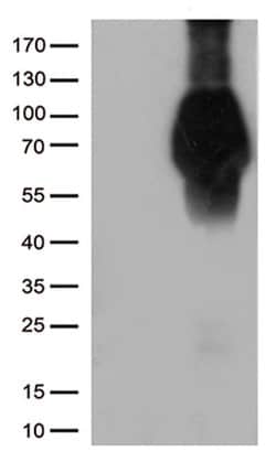 FCGR1A Mouse anti-Human, Clone: UMAB74, liquid, UltraMAB 30 &mu;L; Unconjugated:Antibodies,